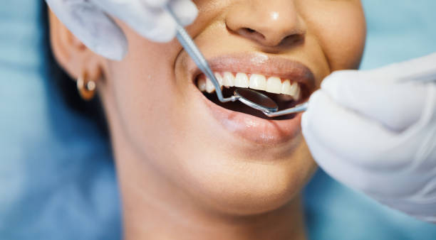 Best Emergency Root Canal Treatment in Tiffin, OH